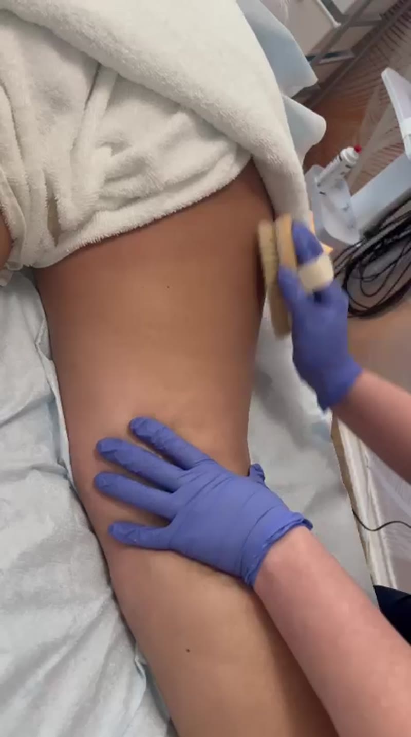 Arm lymphatic drainage