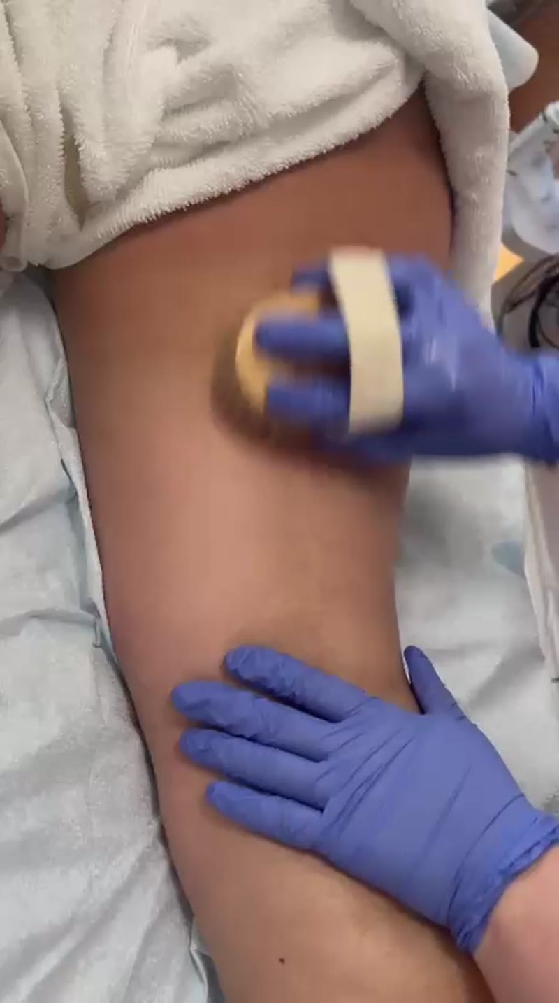 Arm technology treatment